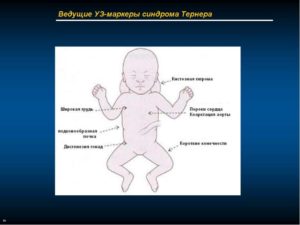 Эхо-маркеры ХА