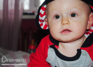 У ребенка пожелтели ладони и нос