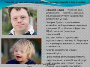 Синдром дауна по кариотипу