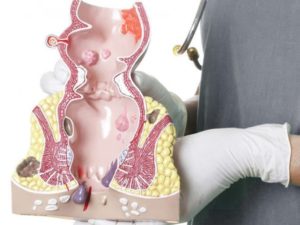 Белая пена из заднего прохода