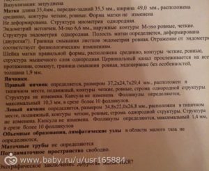 Визуализация затруднена