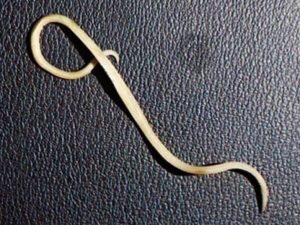 Вытянул длинного червя, с заднего прохода