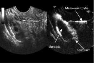 Визуализируется труба