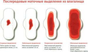 Месячные после лишения девственности