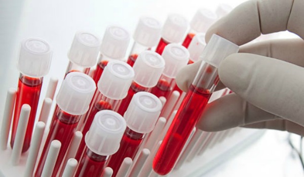 Как не допустить повторную пневмонию