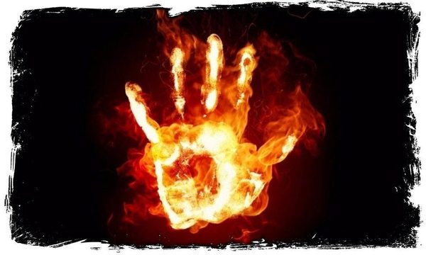 Ëå÷åíèå ðóáöîâ (Íå ÿâëÿåòñÿ êëèíè÷åñêîé ðåêîìåíäàöèåé) Îæîã, Ìåäèöèíà, Êîìáóñòèîëîã, Ðóáöû, Ëå÷åíèå ðóáöîâ, Äëèííîïîñò