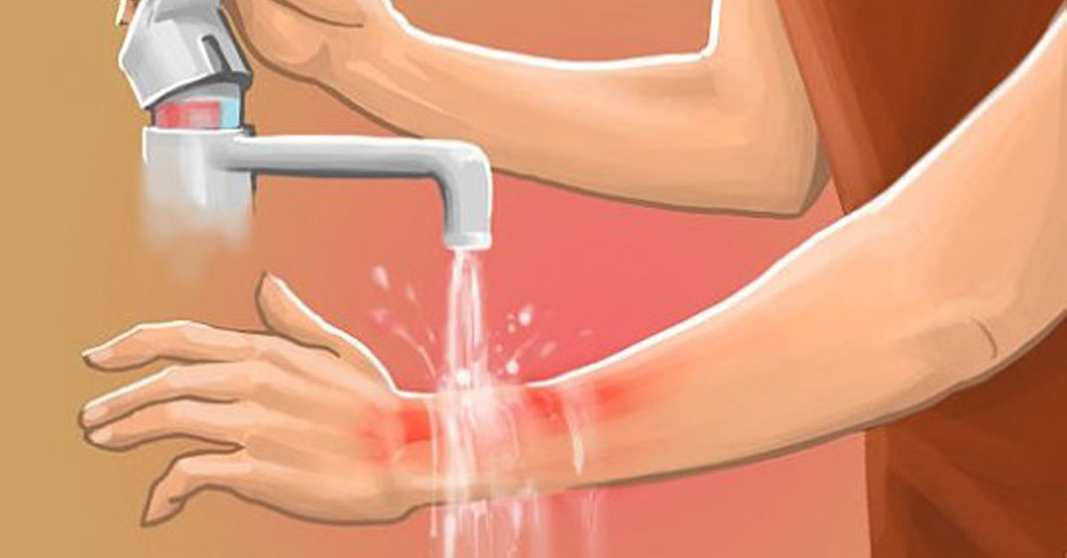 Принципы лечения ожогов и ожоговой болезни