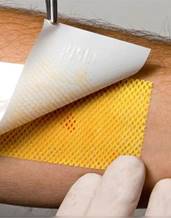 Принципы лечения ожогов и ожоговой болезни