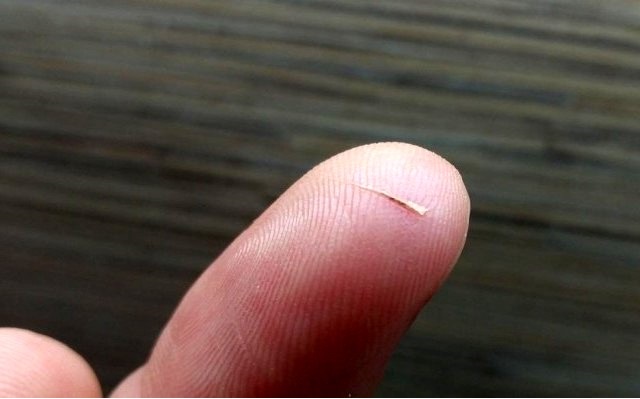 Луиза хей ожог правой руки