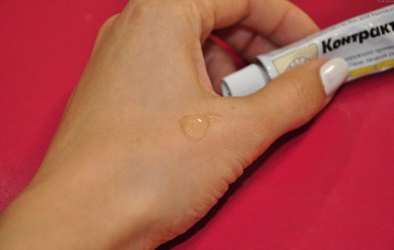 Как убрать следы от ожога лазером Как убрать следы от ожога лазером thumbnail