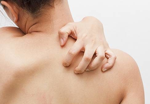 после солнечного ожога чешется кожа что делать