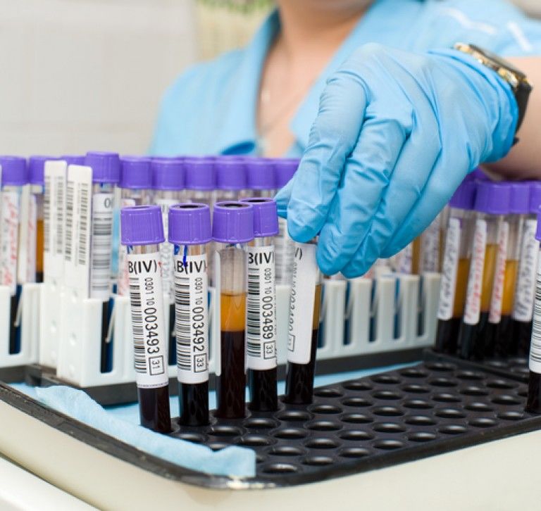 Медсестра собирает биоматериала для диагностики пневмонии