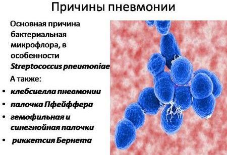 Причины развития пневмонии
