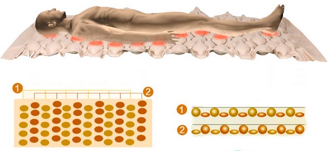 Принцип работы противопролежневого матраса (схематично) Принцип работы противопролежневого матраса (схематично)