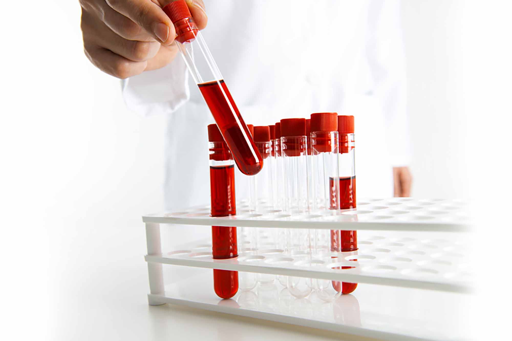 Анализы на выявление пневмонии у ребенка Анализы на выявление пневмонии у ребенка thumbnail