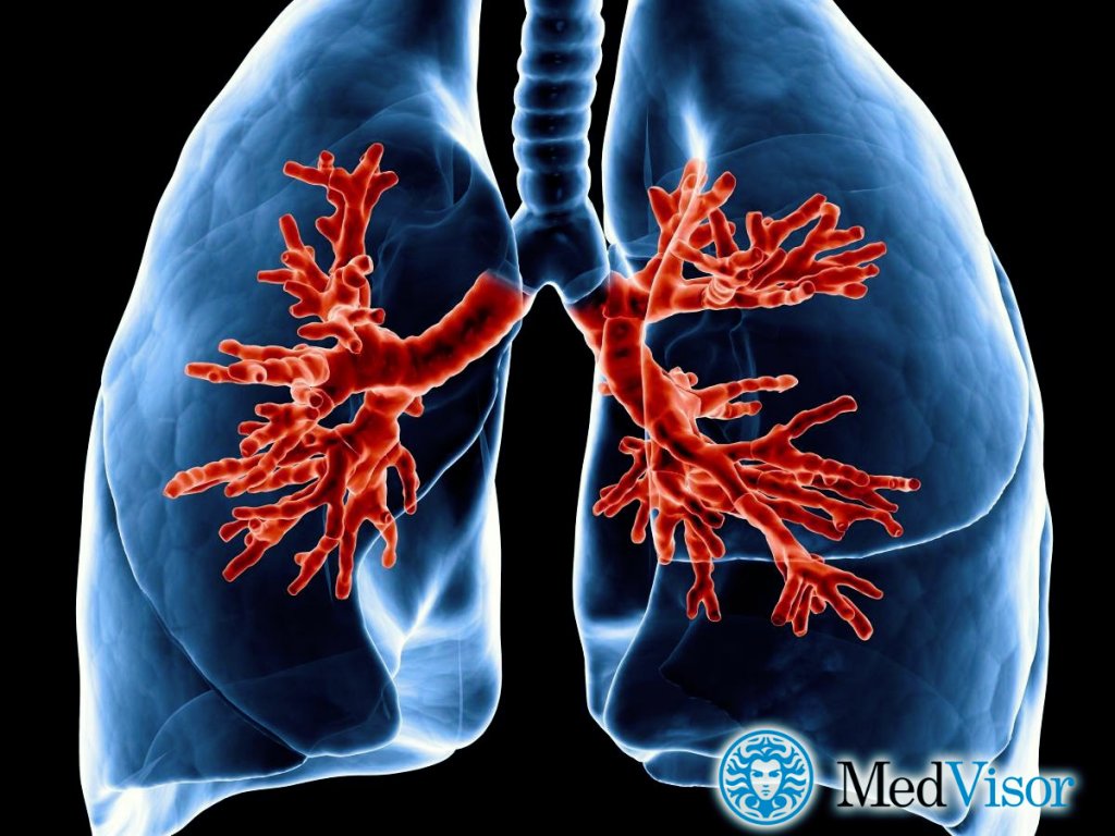 Острый бронхит что это Пневмония лечение и бронхита у