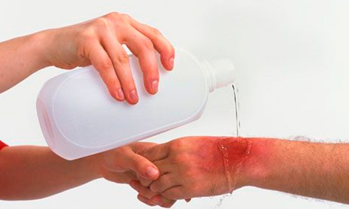 Полейте холодной водой на пораженное место