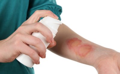 Ожог чем обрабатывать вскрытые волдыри