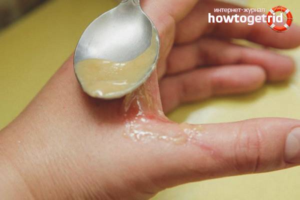 Быстро снимает боль от ожога Быстро снимает боль от ожога thumbnail