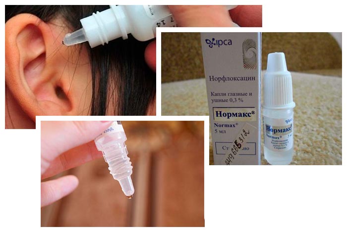 Показания и инструкция по применению ушных капель Нормакс