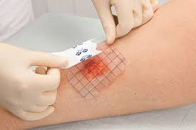 обработка пролежней на дому обработка пролежней на дому