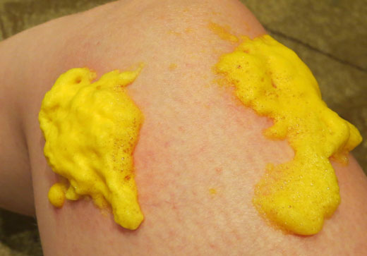 пена от Олазолья на ноге