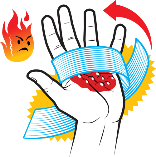 Первая помощи при ожогах