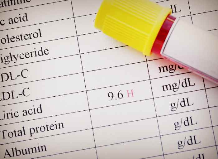 Сдача анализов при подагре