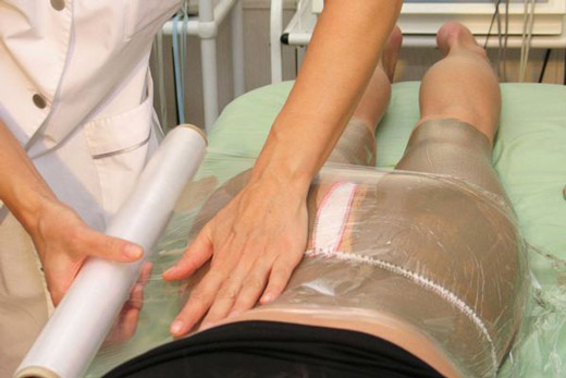 обертывание горчицей от целлюлита