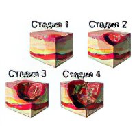 Мазь от пролежней с пчелиным воском