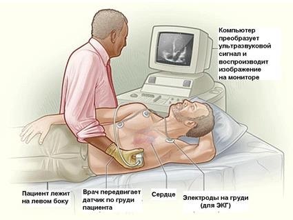 Правосторонняя пневмония нижней доли легкого симптомы Правосторонняя пневмония нижней доли легкого симптомы thumbnail