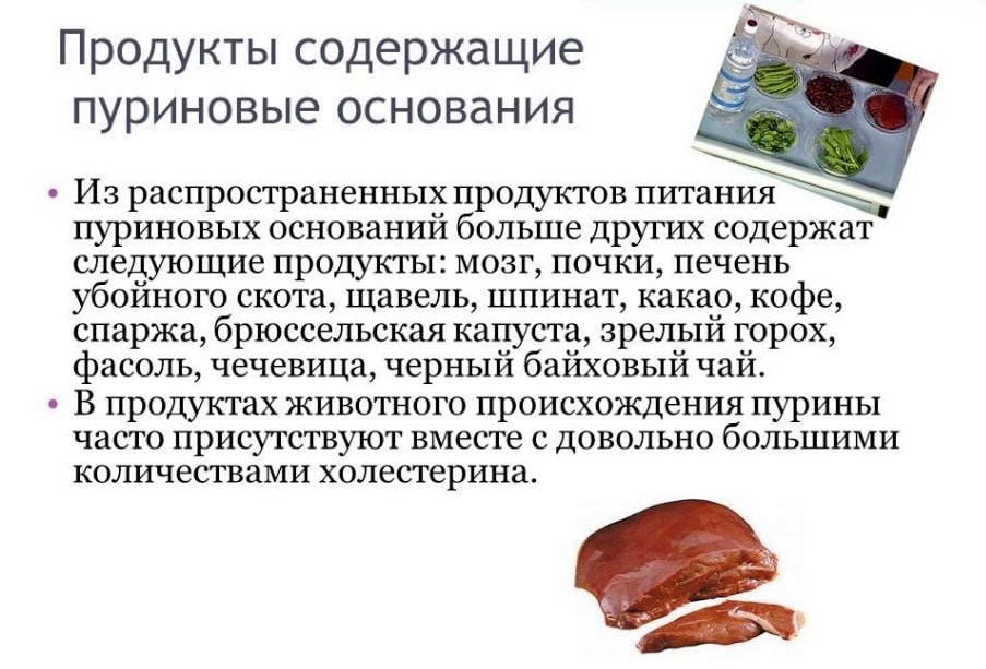 Остеоартроз коленного сустава это подагра