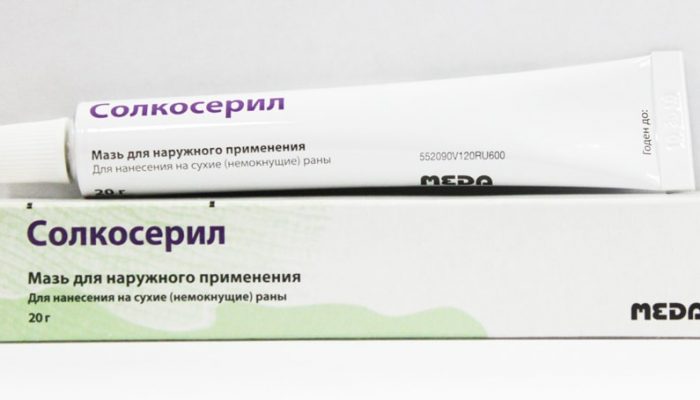 Как лечить ожог с гнойничками