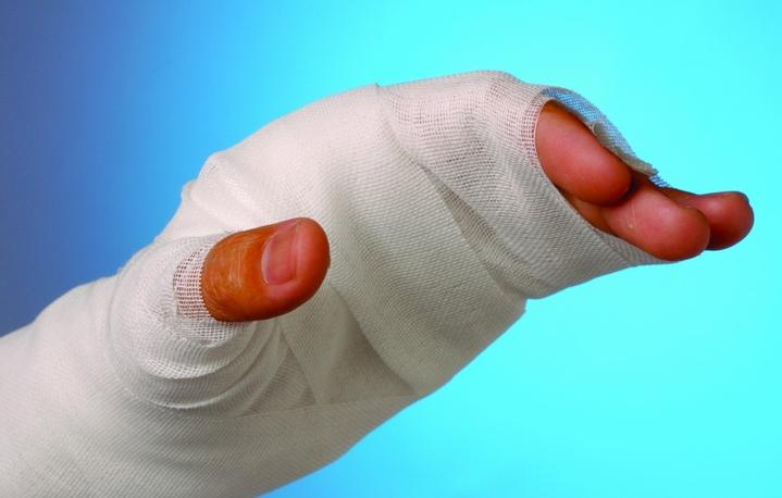 Нагноение ожога Нагноение ожога